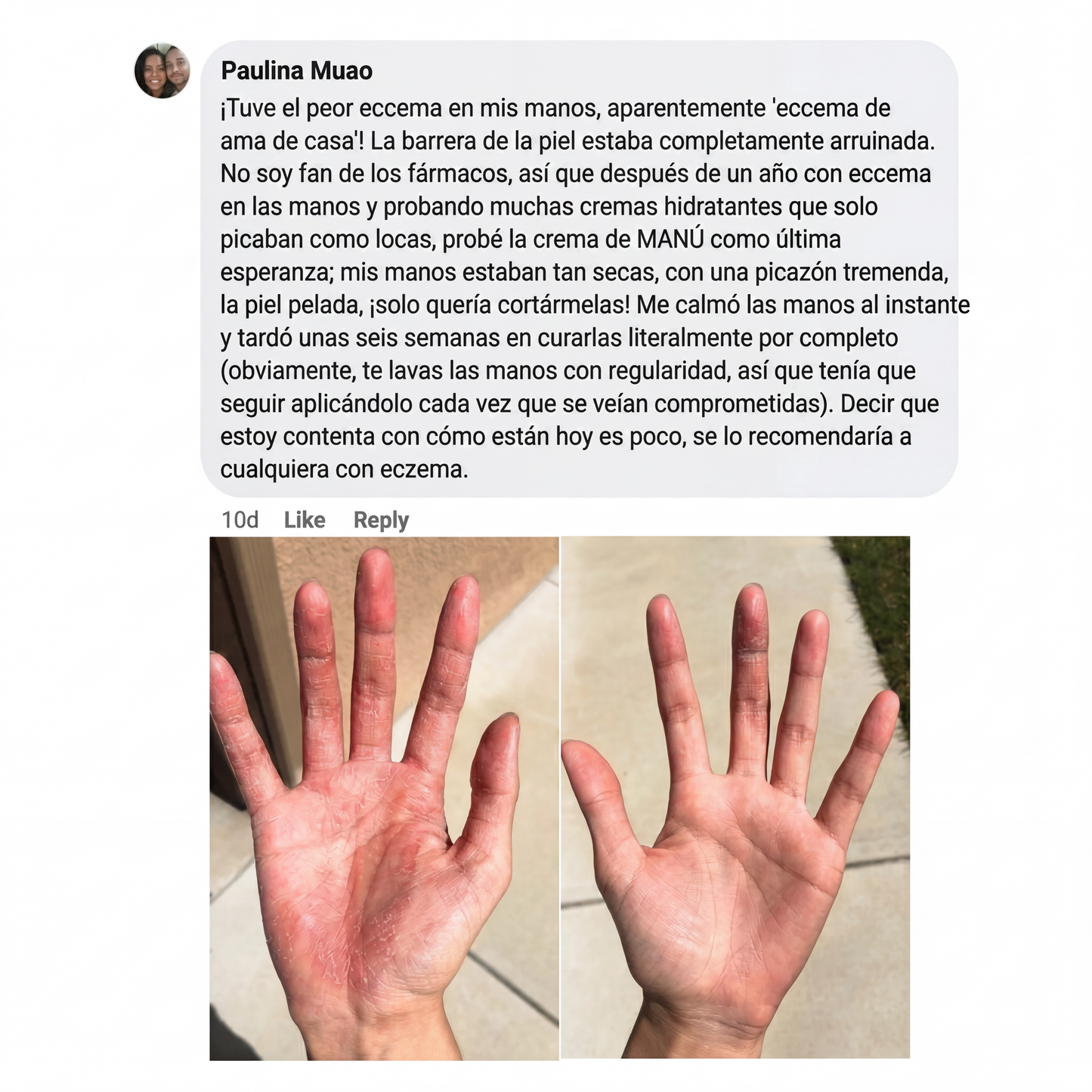 Crema natural MANÚ ® Anti Eczema 100 g