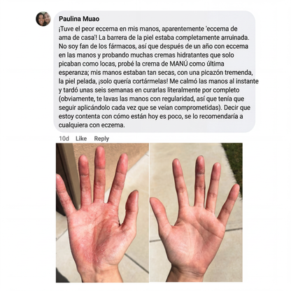 Crema natural MANÚ ® Anti Eczema 100 g